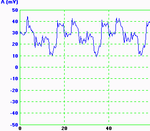 10-40mv amplitude